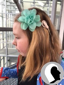 CI Kopf 2018 weiblich Kind